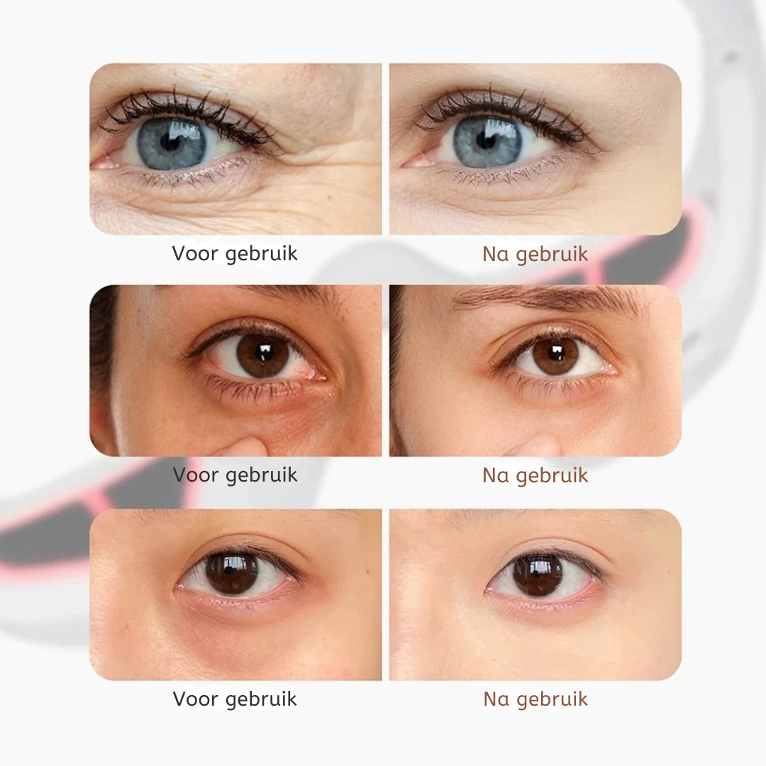 RecoverX™ OogSpa Bril - Tegen Rimpels, Wallen en Vermoeide Ogen