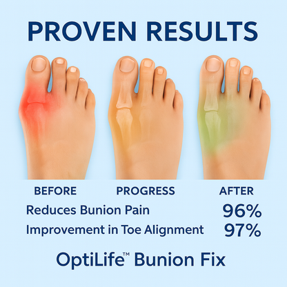 OptiLife Hallux Valgus Corrector