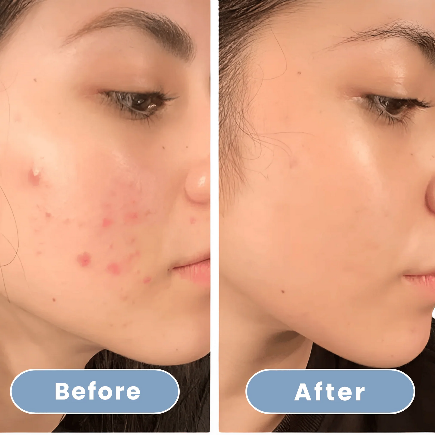 Aqualuce PureFlow – Luxe Douchekop met Massagefunctie & Filters
