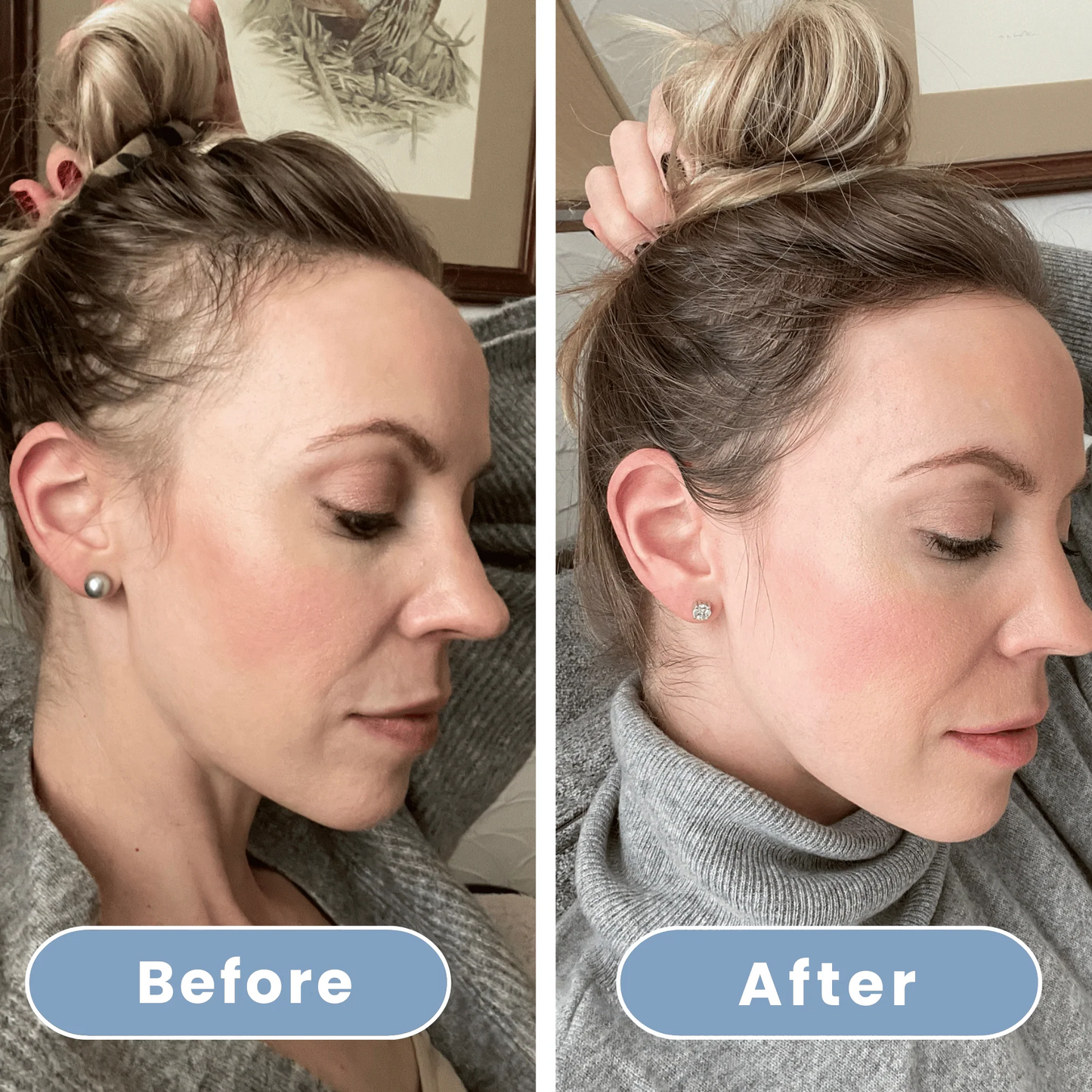 Aqualuce PureFlow – Luxe Douchekop met Massagefunctie & Filters