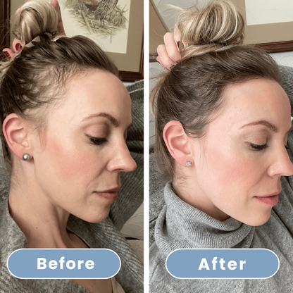 Aqualuce PureFlow – Luxe Douchekop met Massagefunctie & Filters