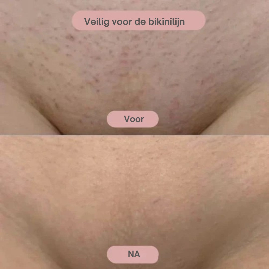 Pure Elegance™ 2-in-1 Ladyshave – Intiem glad zonder irritatie