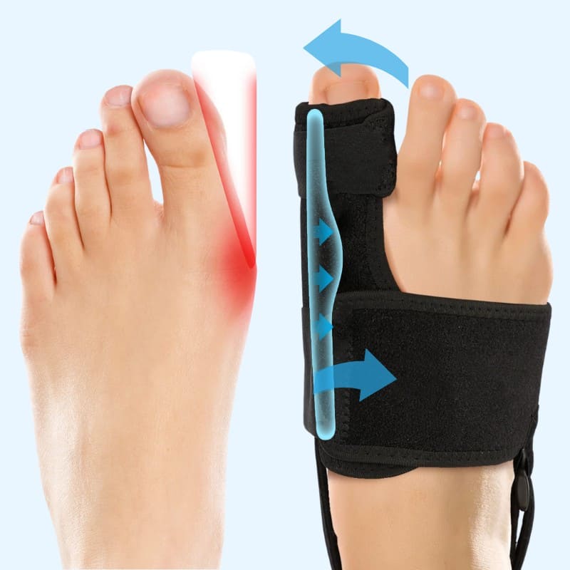 Valgux™ Brace | Teencorrector bij scheefstand (Hallux Valgus)