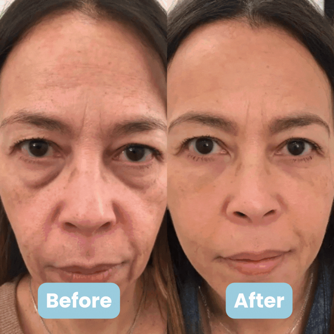 Sirasilk 3-in-1 LED geszichtsculptor