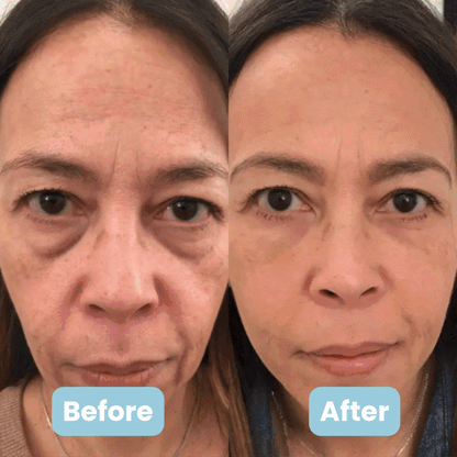 Sirasilk 3-in-1 LED geszichtsculptor