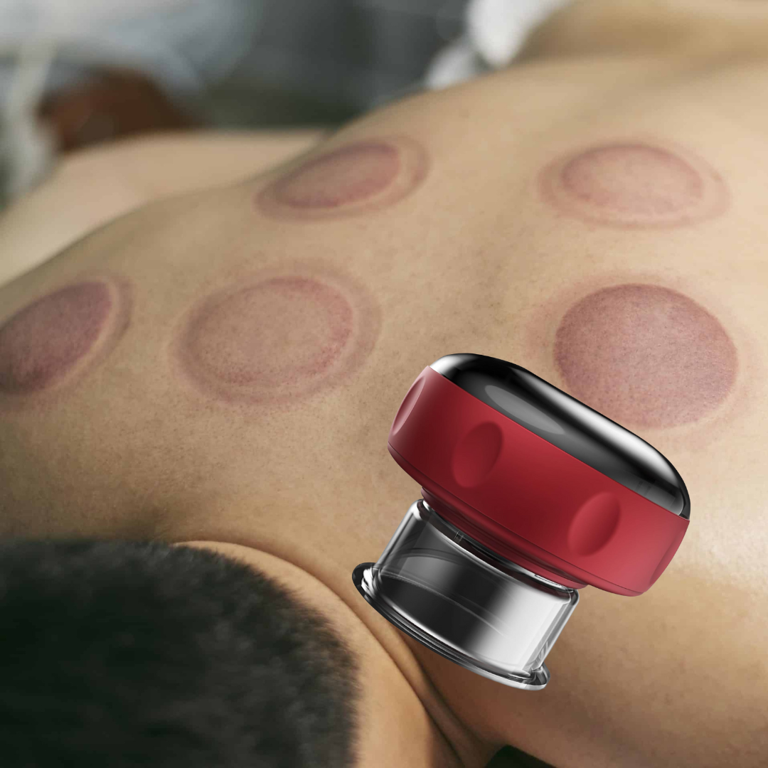 RecoverX™ – Elektrische Cupping Cup | Spierherstel & Pijnverlichting na Training