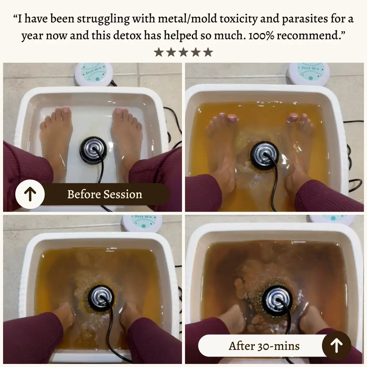 Recover X - Ionische Voetspa | Verwijder gifstoffen en zware metalen voor een gezonder leven